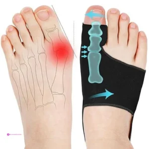 Consss Bunion Correctors Code Skzewk5…