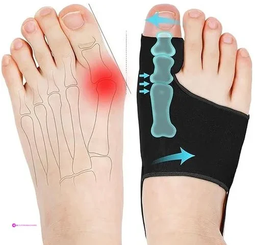 Consss Bunion Correctors Code Skzewk5…