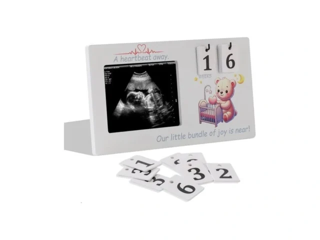 Aovdy Baby Sonogram Picture Frame – Ultrasound… Code