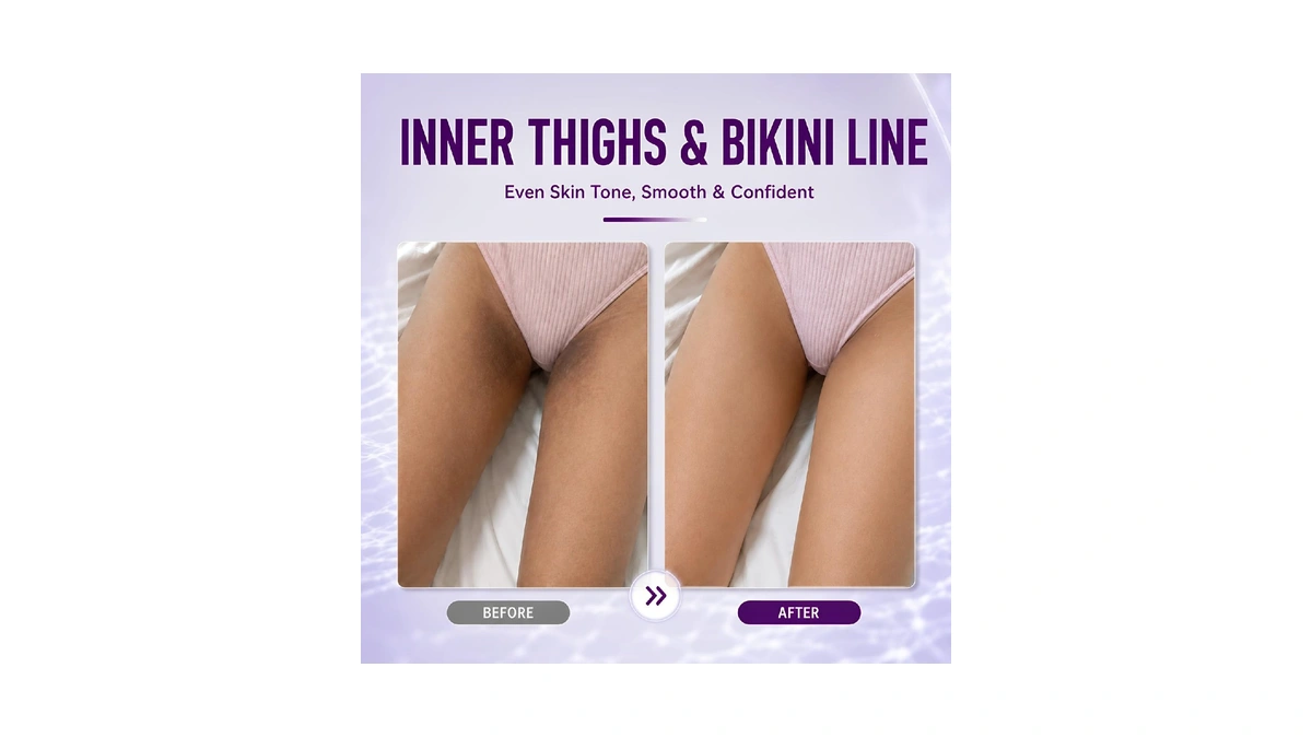 Skin Bleaching Cream, Dark Spot Remover For Body, Skin Lightening