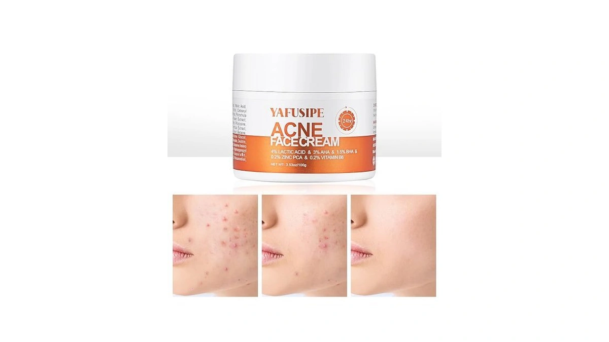 Yafusipe Acne Treatment For Face For Hormonal Cystic Stubborn Acne