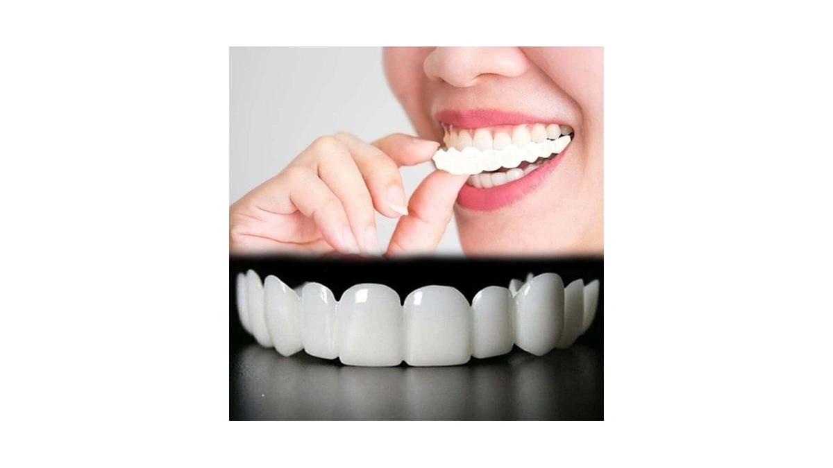 Temporary Veneers Kit For Women And Men